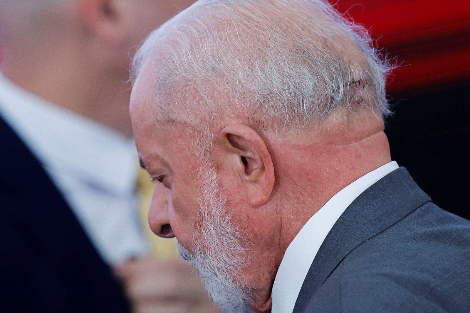 Lula retirou dreno e está sob cuidados ‘intensivos’