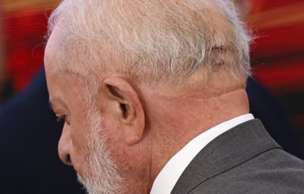Pacheco diz que Lula estava abatido antes de ser internado
