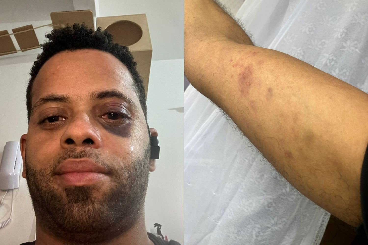 Homem alega ter sido espancado por PMs durante passeio com gatos de estimação no litoral de SP: ‘Racismo’