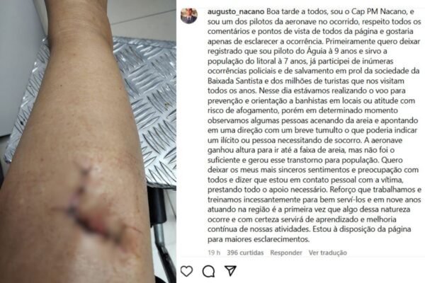 Piloto da PM pede desculpas após sobrevoar praia e causar lesão em turista