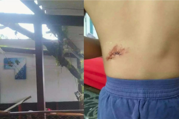 Criança de 3 anos é atingida por galho de quase oito metros enquanto brincava em casa; imóvel foi destruído