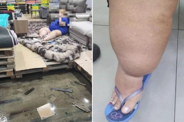 Turista que fez bariátrica fica com pé preso em ‘chão falso’ de loja e entra na Justiça: ‘Gatilhos’