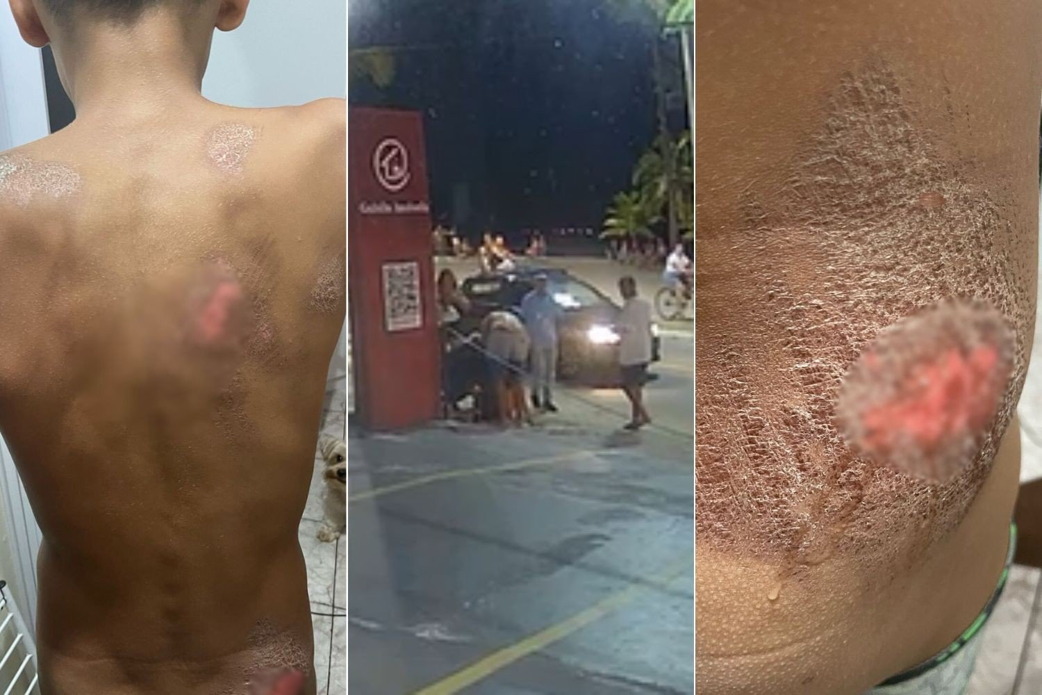 Motorista de carro de luxo foge após atropelar turista de 12 anos na faixa de pedestres; VÍDEO