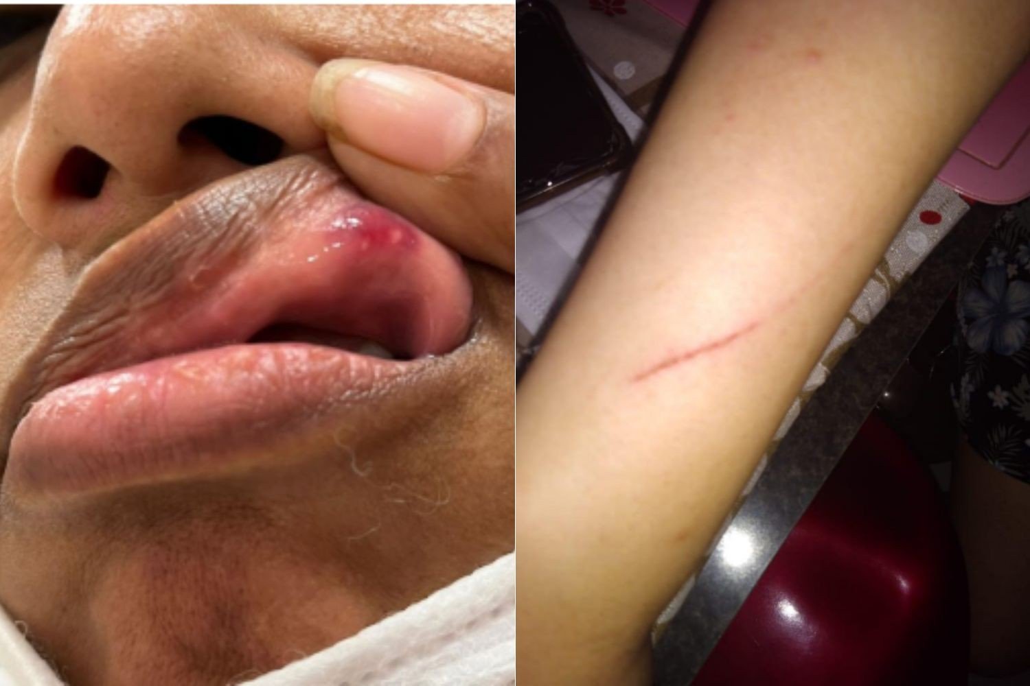 Mãe e filha atacadas por não cederem assento a criança em avião vão processar agressores, diz advogada