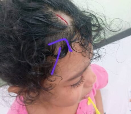 “Minha filha sofreu nas mãos de quem devia cuidar”: Mãe denuncia médico por erro grave em pronto-socorro de Embu das Artes