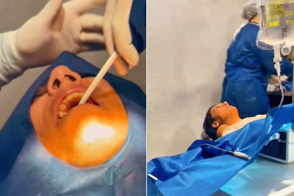 Ex-Casal Maloka transforma vida da mãe com implantes dentários após 20 anos de sofrimento; veja antes e depois