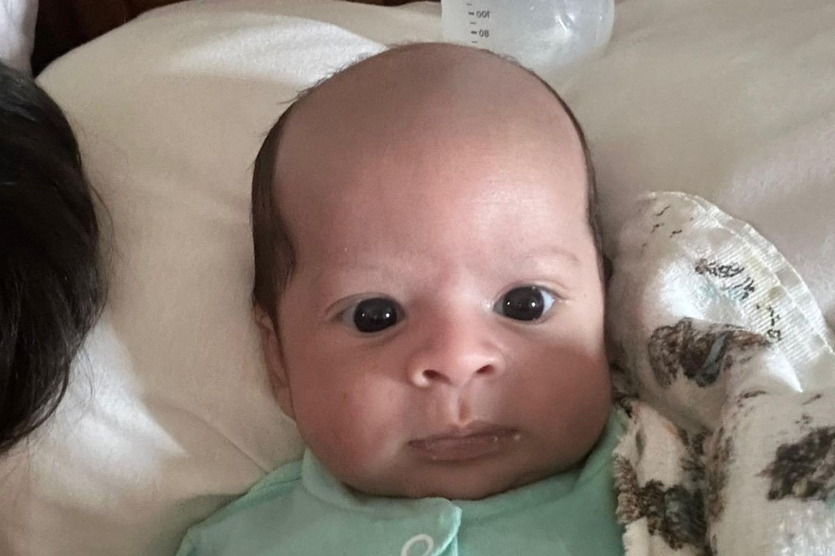 Bebê ‘calvo’ viraliza na web após nascer parecendo ‘um senhor de 82 anos’; VEJA