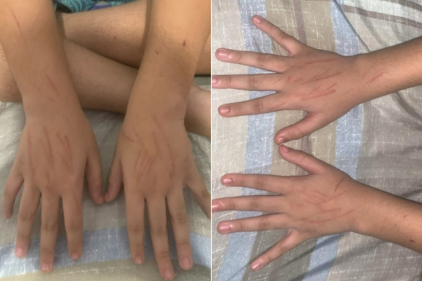 Estudante é agredido na saída de escola no litoral de SP: ‘Está em choque’, diz pai