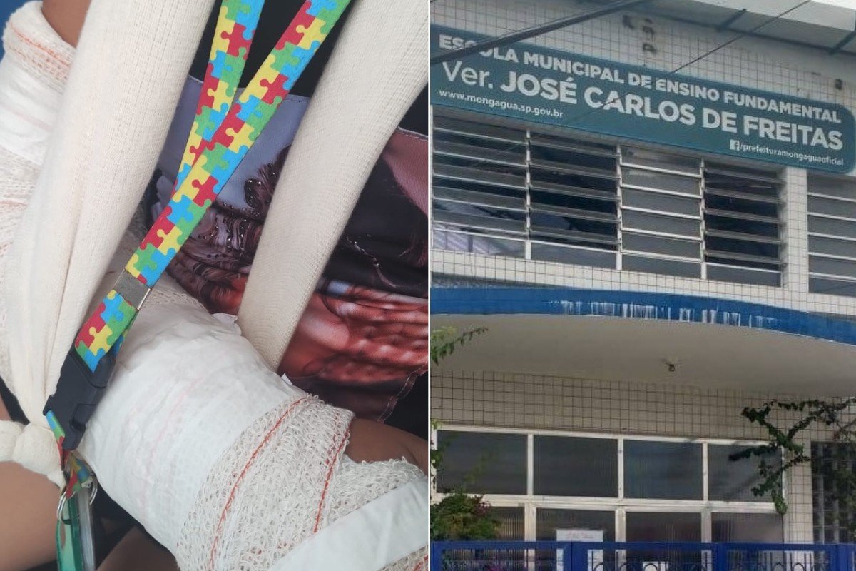 Menina autista é agredida e sofre fratura no pulso em escola do litoral de SP