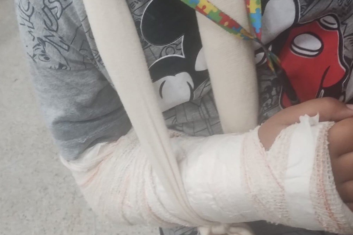 Mãe de menina que teve pulso fraturado após agressão em escola cobra punição: ‘Isso tem que parar’