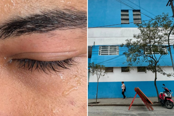 Aluno é agredido durante aula de educação física e sofre inflamação no olho em escola do litoral de SP