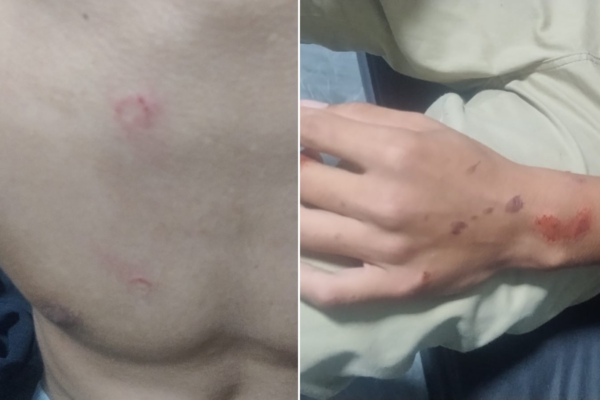 Adolescente atropelado por ônibus a caminho da escola fala pela primeira vez após acidente no litoral de SP Adolescente atropelado por ônibus a caminho da escola fala pela primeira vez após acidente no litoral de SP