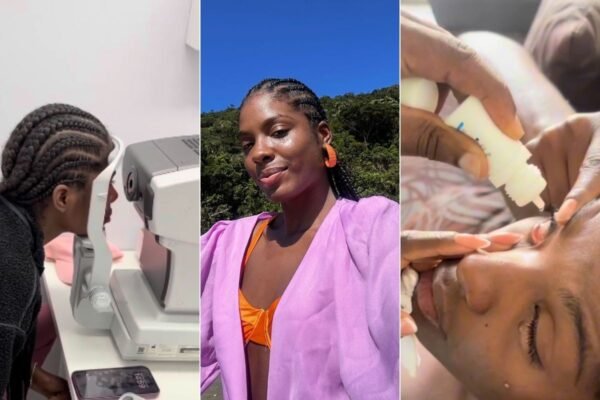 Modelo fica com córneas queimadas e perde a visão após usar pomada modeladora no cabelo