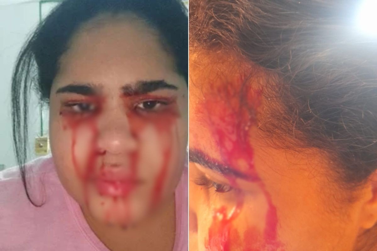 Jovem que sangra pelo nariz, boca, ouvidos e olhos passa a ‘suar sangue’ e busca tratamento no Nordeste