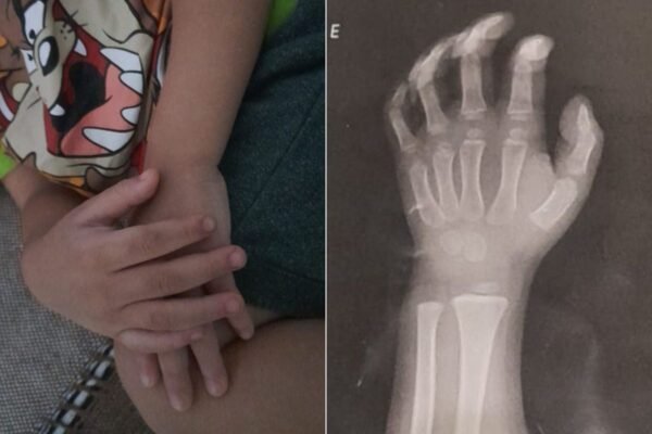 Professora é demitida após agredir aluno de três anos em creche no litoral de SP Professora é demitida após agredir aluno de três anos em creche no litoral de SP
