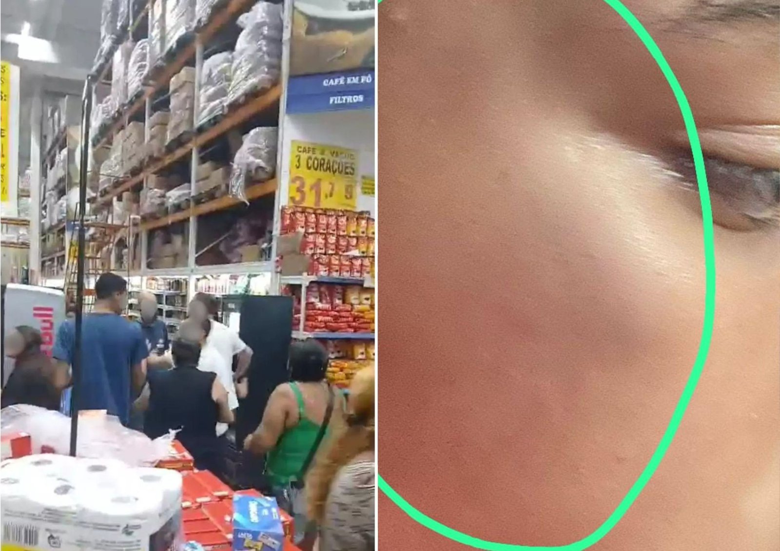 Família pede indenização de R$ 182 mil a mercado após idoso ser chamado de ‘aleijado’ e ter filhos agredidos