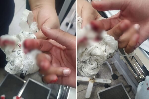 Mãe revela trauma da filha que perdeu dedo durante agressão de colegas em escola de SP Mãe revela trauma da filha que perdeu dedo durante agressão de colegas em escola de SP