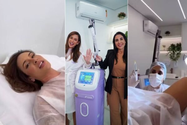 Médica revela que mãe da ex-BBB Vanessa Lopes passou por cirurgia íntima em busca de ‘rejuvenescimento’