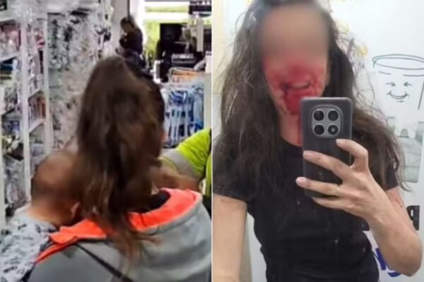 Mulher agredida por assaltante enquanto amamentava filho teme pela família: ‘Ele sabe onde me encontrar’