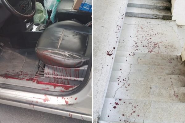 Motorista é atacado com facão após briga no trânsito, tem nervo e artéria rompidos e dirige ferido até delegacia