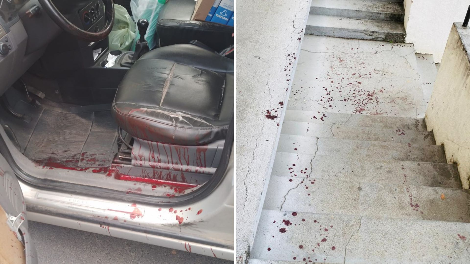 Motorista é atacado com facão após briga no trânsito, tem nervo e artéria rompidos e dirige ferido até delegacia