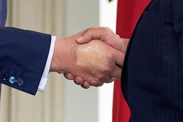 Trump foi flagrado com mão maquiada e pés inchados antes de diagnóstico de insuficiência venosa crônica; VEJA FOTOS