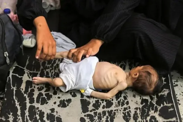 ‘Pais estão famintos demais para cuidar das crianças’: a corrida para liberar ajuda humanitária em Gaza