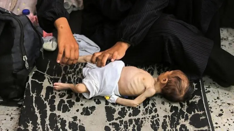 ‘Pais estão famintos demais para cuidar das crianças’: a corrida para liberar ajuda humanitária em Gaza