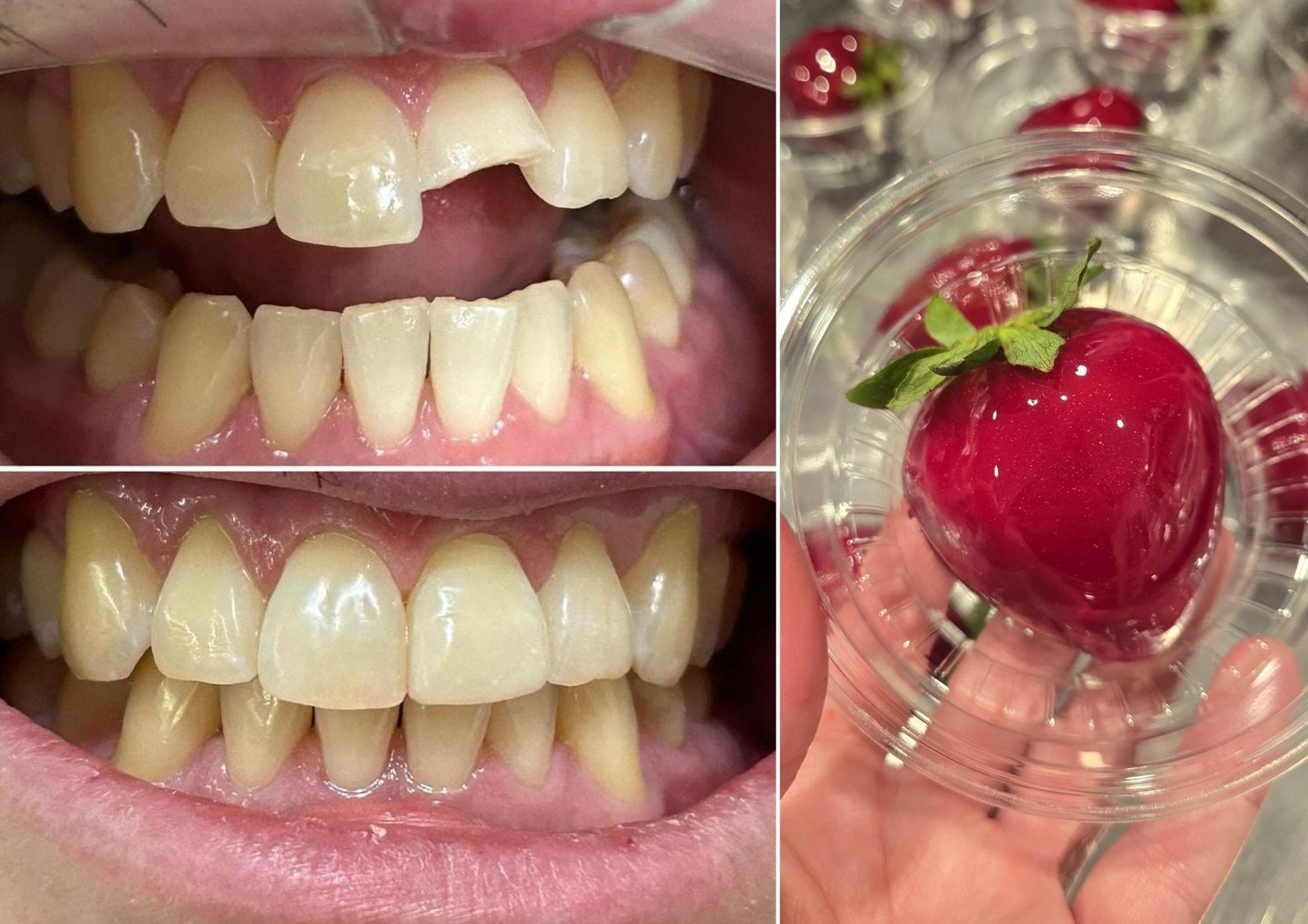 ‘Morango do Amor’ causa fraturas dentárias e dentistas alertam: ‘Bomba de açúcar’