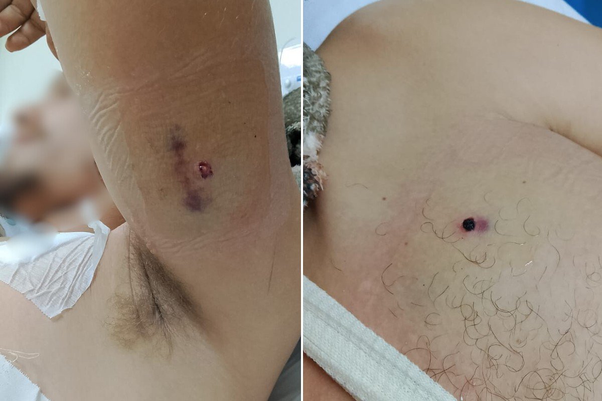 Homem é baleado por ex-chefe na frente da mãe e da esposa em sítio no interior de SP