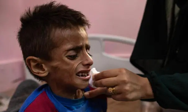 Gaza enfrenta ‘pior cenário possível de fome’, diz órgão de segurança alimentar ligado à ONU