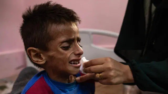 Gaza enfrenta ‘pior cenário possível de fome’, diz órgão de segurança alimentar ligado à ONU