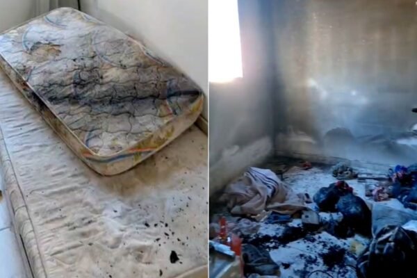 Menino que sobreviveu a incêndio provocado pela irmã recebe alta da UTI após duas semanas